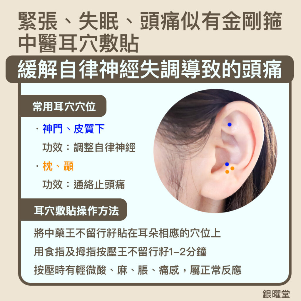 緊張失眠、頭痛似有金剛箍，中醫用耳穴敷貼，刺激耳仔特定的穴位反應區，例如神門、皮質下、枕、顳等，能改善頭痛失眠問題。